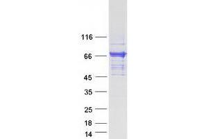 Validation with Western Blot (CAMKK2 Protein (Transcript Variant 2) (Myc-DYKDDDDK Tag))
