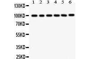 Anti- STIM1 Picoband antibody, Western blotting All lanes: Anti STIM1  at 0. (STIM1 anticorps  (N-Term))