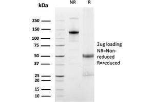 SDS-PAGE Analysis Purified FCGRT Mouse Monoclonal Antibody (FCGRT/2932).