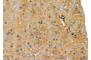 ABIN6259272 and ABIN6276054 at 1/100 staining Rat brain tissue by IHC-P. (MC1 Receptor anticorps  (C-Term))