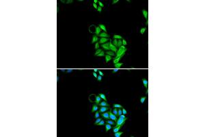 Immunofluorescence analysis of U2OS cells using JADE1 antibody (ABIN5973751). (PHF17 anticorps)