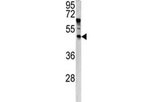 Western blot analysis of ANGPTL7 antibody and HeLa lysate.