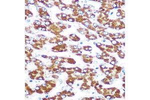 Immunohistochemistry of paraffin-embedded human liver using IDO1 Rabbit mAb (ABIN7267863) at dilution of 1:100 (40x lens). (IDO1 anticorps)