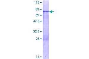 Image no. 1 for Mohawk Homeobox (MKX) (AA 1-352) protein (GST tag) (ABIN1310992)