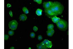 Immunofluorescence staining of MCF-7 with ABIN7146416 at 1:50, counter-stained with DAPI. (PDE1B anticorps  (AA 1-277))