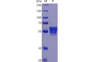 Human CD7 Protein, mFc Tag on SDS-PAGE under reducing condition.