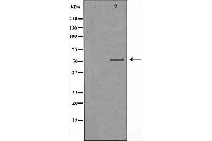 Western blot analysis of extracts from LOVO cells, using Cytochrome P450 7B1 antibody. (CYP7B1 anticorps  (Internal Region))