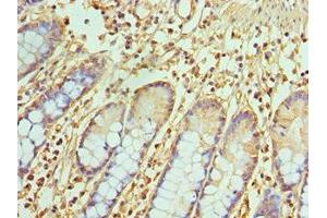 Immunohistochemistry of paraffin-embedded human small intestine tissue using ABIN7172071 at dilution of 1:100 (TREX1 anticorps  (AA 1-270))