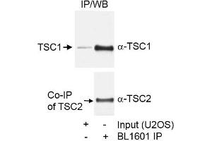 Immunoprecipitation (IP) image for anti-Tuberous Sclerosis 1 (TSC1) (C-Term) antibody (ABIN7449615) (TSC1 anticorps  (C-Term))