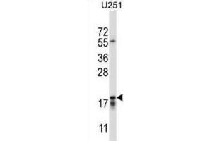 Western Blotting (WB) image for anti-Cancer/testis Antigen 2 (CTAG2) antibody (ABIN2997526) (CTAG2 anticorps)