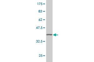 Western Blot detection against Immunogen (37.