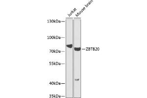 Western blot analysis of extracts of various cell lines, using ZBTB20 antibody (ABIN6130809, ABIN6150372, ABIN6150373 and ABIN6223978) at 1:1000 dilution.