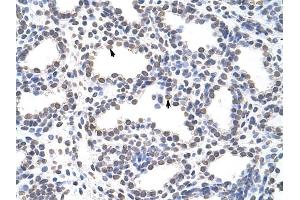 CARS antibody was used for immunohistochemistry at a concentration of 4-8 ug/ml to stain Alveolar cells (arrows) in Human Lung.