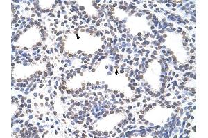 CARS antibody was used for immunohistochemistry at a concentration of 4-8 ug/ml to stain Alveolar cells (arrows) in Human Lung. (CARS anticorps  (C-Term))