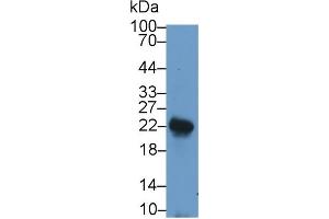 Detection of LIF in Rat Spleen lysate using Polyclonal Antibody to Leukemia Inhibitory Factor (LIF) (LIF anticorps  (AA 2-201))
