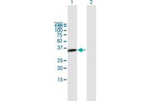 Western Blot analysis of C2 expression in transfected 293T cell line by C2 MaxPab polyclonal antibody. (Complement C2 anticorps  (AA 20-328))