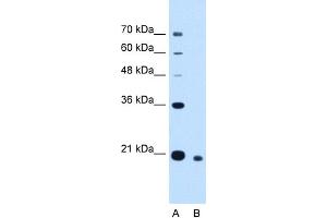 WB Suggested Anti-CDCA4 Antibody Titration:  2.
