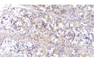 Detection of IL13 in Porcine Stomach Tissue using Polyclonal Antibody to Interleukin 13 (IL13) (IL-13 anticorps  (AA 25-131))