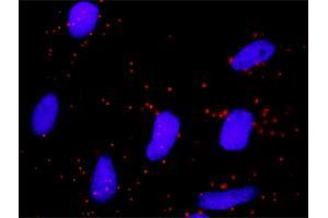 Proximity Ligation Analysis of protein-protein interactions between NFKBIB and FBXW11.