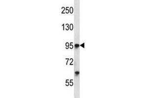 Tie1 antibody western blot analysis in K562 lysate. (TIE1 anticorps  (AA 361-389))
