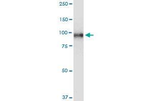 TOP1 monoclonal antibody (M01), clone 1A1.