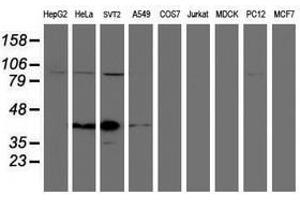 Image no. 1 for anti-Spastic Paraplegia 7 (SPG7) (AA 300-573) antibody (ABIN1491371) (SPG7 anticorps  (AA 300-573))