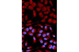 Immunofluorescence (IF) image for anti-Pyruvate Dehydrogenase (Lipoamide) alpha 1 (PDHA1) (AA 30-390) antibody (ABIN3023697) (PDHA1 anticorps  (AA 30-390))