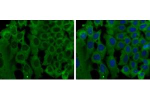 ICC/IF Image Liprin alpha 1 antibody [N1N2], N-term detects Liprin alpha 1 protein at cytoplasm by immunofluorescent analysis.