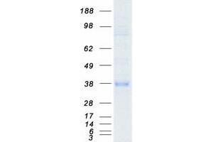 Validation with Western Blot