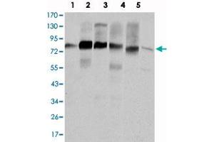 Western blot analysis using CTTN monoclonal antibody, clone 4C6  against HeLa (1) , A-431 (2) , MCF-7 (3) , SR-BR-3 (4) , HepG2 (5) and NIH/3T3 (6) cell lysate.