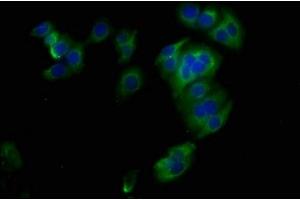 Immunofluorescence staining of HepG2 cells with ABIN7171189 at 1:400, counter-stained with DAPI. (Syndecan 1 anticorps  (AA 23-254))