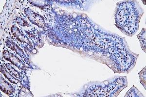 IHC analysis of PCNA using anti-PCNA antibody (ABIN7599181).