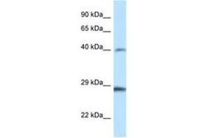 Image no. 1 for anti-Homeobox B9 (HOXB9) (AA 20-69) antibody (ABIN6747415) (HOXB9 anticorps  (AA 20-69))