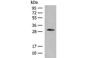 Western blot analysis of Human left thymus tissue lysate using VDAC3 Polyclonal Antibody at dilution of 1:200 (VDAC3 anticorps)