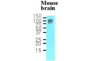 Tissue lysates of mouse brain(30 ug) were resolved by SDS-PAGE, transferred to nitrocellulose membrane and probed with anti-human APP (1:1000). (APP anticorps  (AA 18-289))