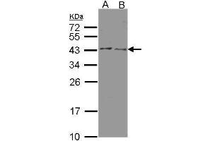 WB Image Sample(30 μg of whole cell lysate) A:HeLa S3 , B:MOLT4, 12% SDS PAGE antibody diluted at 1:500 (HSD3B2 anticorps)