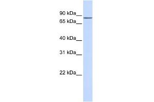 WB Suggested Anti-ZNF420 Antibody Titration:  0. (ZNF420 anticorps  (N-Term))