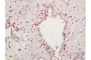 Formalin-fixed and paraffin embedded human placenta labeled with Anti-MAPK11 Polyclonal Antibody, Unconjugated (ABIN754393) at 1:200 followed by conjugation to the secondary antibody and DAB staining