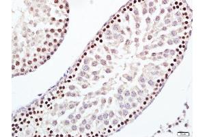 Paraformaldehyde-fixed, paraffin embedded rat testis tissue, Antigen retrieval by boiling in sodium citrate buffer(pH6) for 15min, Block endogenous peroxidase by 3% hydrogen peroxide for 30 minutes, Blocking buffer (normal goat serum) at 37°C for 20min, Antibody incubation with Rabbit Anti-ERCC1 Polyclonal Antibody, Unconjugated  at 1:200 overnight at 4°C, followed by a conjugated secondary and DAB staining