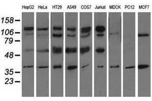 Image no. 2 for anti-CD5 (CD5) antibody (ABIN1497337) (CD5 anticorps)