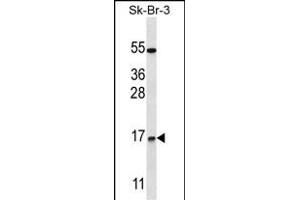 NRARP Antibody (Center) (ABIN657561 and ABIN2846568) western blot analysis in SK-BR-3 cell line lysates (35 μg/lane). (NRARP anticorps  (AA 56-83))