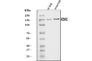 Western blot analysis of H-ERG/KCNH2 using anti-H-ERG/KCNH2 antibody (ABIN7599901).