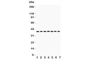 Western blot testing of Nucleophosmin antibody and Lane 1:  rat testis (NPM1 anticorps  (AA 1-294))