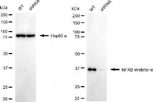 Western blotting analysis using NFKB inhibitor alpha antibody (ABIN7799642).