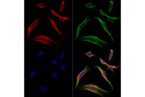 ABIN6261376 and ABIN6277015 staining Hela cells by IF/ICC. (Dystonin anticorps  (C-Term))