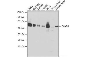 Western blot analysis of extracts of various cell lines using CXADR Polyclonal Antibody at dilution of 1:1000. (Coxsackie Adenovirus Receptor anticorps)
