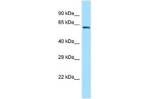 WB Suggested Anti-SOWAHC Antibody Titration: 1.
