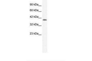 Image no. 2 for anti-Cation Channel, Sperm Associated 2 (CATSPER2) (AA 31-80) antibody (ABIN203121) (CATSPER2 anticorps  (AA 31-80))