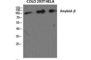 Western Blot (WB) analysis of specific cells using Amyloid-beta Polyclonal Antibody. (beta Amyloid anticorps  (Ser15))