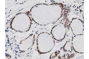 Immunohistochemistry (IHC) image for anti-DnaJ (Hsp40) Homolog, Subfamily A, Member 2 (DNAJA2) antibody (ABIN1497862)